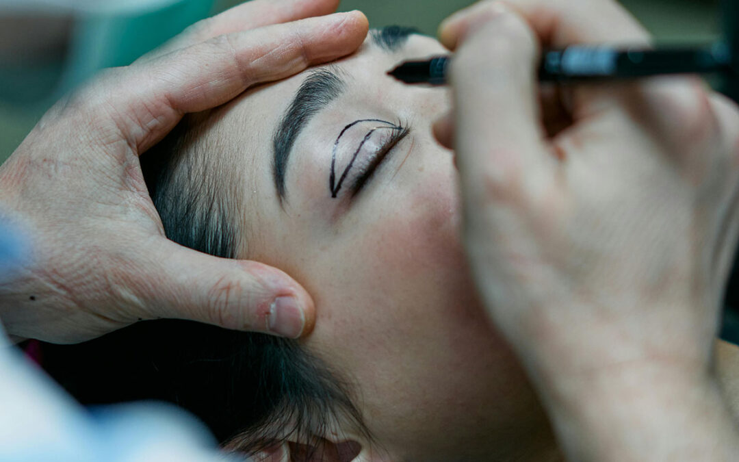 Eyelid Surgery 7585312