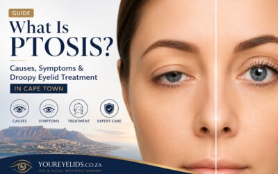 What Is Ptosis? Causes, Symptoms & Droopy Eyelid Treatment in Cape Town